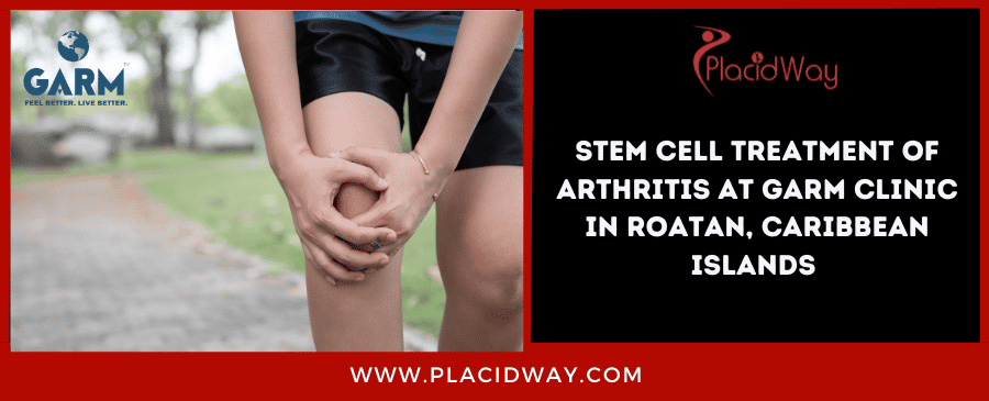Stem Cell Arthritis Treatment