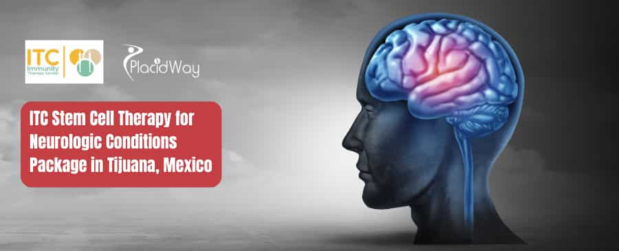 Stem Cell Therapy for Neurologic Conditions Package by ITC in Tijuana, Mexico