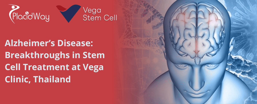 Alzheimer Disease: Breakthroughs in Stem Cell Treatment at Vega Clinic in Thailand