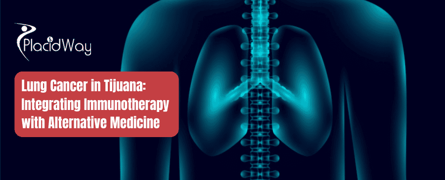 Lung Cancer in Tijuana Integrating Immunotherapy with Alternative Medicine