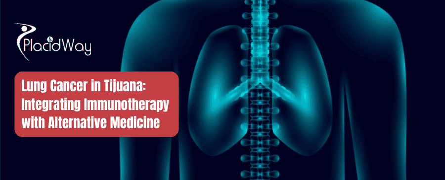 Cáncer de pulmón en Tijuana: integrando inmunoterapia con medicina alternativa