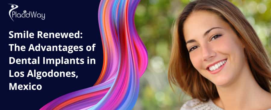 Smile Renewed: The Advantages of Dental Implants in Los Algodones, Mexico