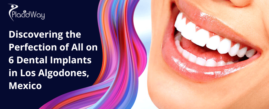 Discovering the Perfection of All on 6 Dental Implants in Los Algodones, Mexico
