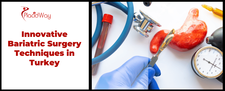 Innovative Bariatric Surgery Techniques in Turkey
