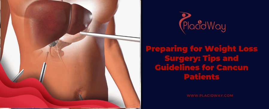 Weight Loss Surgery in Cancun: Essential Preparation Tips and Guidelines Weight Loss Surgery in Cancun: Essential Preparation Tips and Guidelines