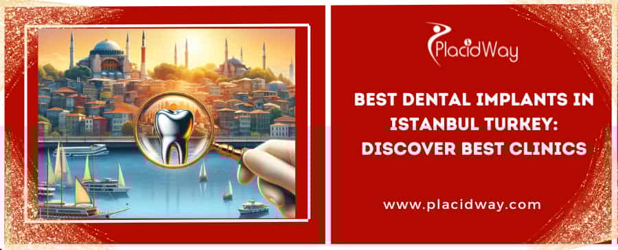 Best Dental Implants in Istanbul Turkey: Discover Best Clinics