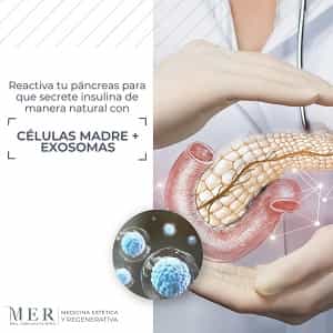 Clinica MER in Mexico City, Mexico Stem Cell Therapy