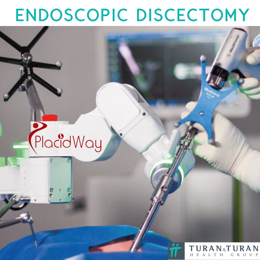 Endoscopic Discectomy
