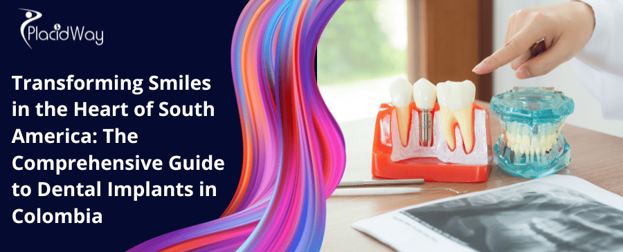 Transforming Smiles in the Heart of South America: The Comprehensive Guide to Dental Implants in Colombia