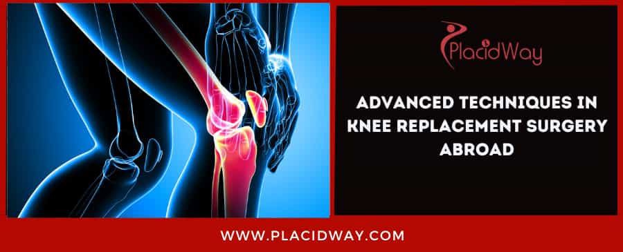 Advanced Techniques in Knee Replacement Surgery Abroad
