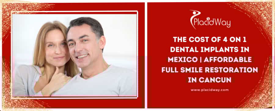 The Cost of 4 on 1 Dental Implants in Mexico | Affordable Full Smile Restoration in Cancun