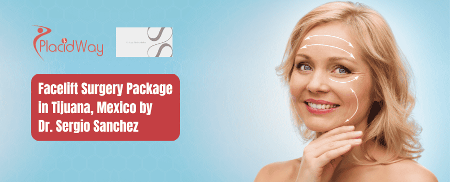 Paquete de cirugía de lifting facial en Tijuana, México por el Dr. Sergio Sánchez