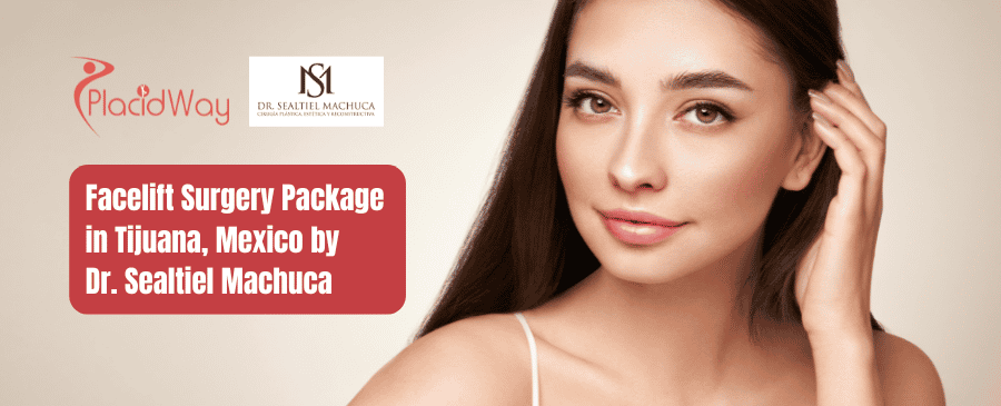 Facelift Surgery Package in Tijuana, Mexico by Dr. Sealtiel Machuca