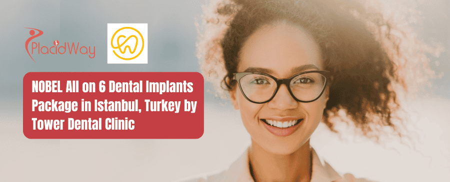 NOBEL All on 6 Dental Implants Package in Istanbul, Turkey by Tower Dental Clinic
