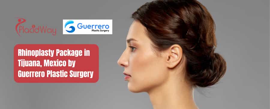 Rhinoplasty Package in Tijuana, Mexico by Guerrero Plastic Surgery