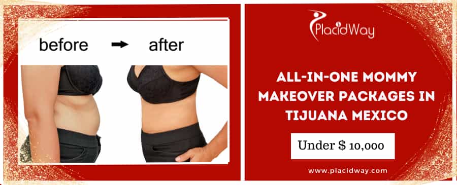 Mommy Makeover in Tijuana, Mexico