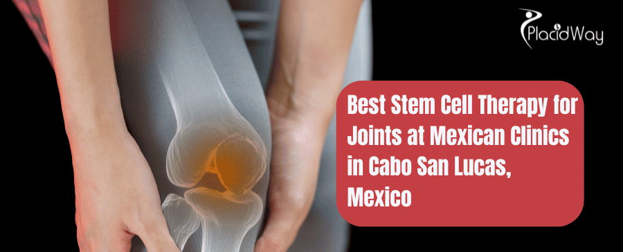Stem Cell Therapy for Joints in Cabo San Lucas, Mexico