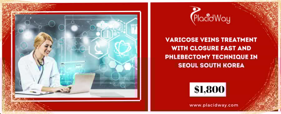 Varicose Veins Treatment with Closure Fast and Phlebectomy Technique in Seoul South Korea