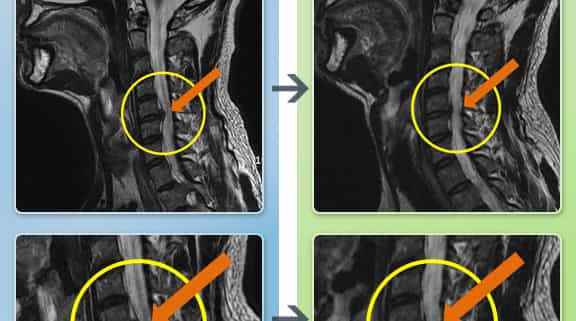 Before and After Image