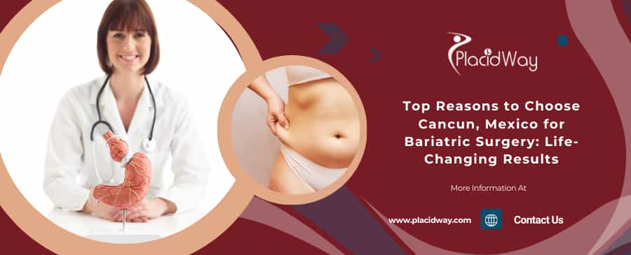 Top Reasons to Choose Cancun, Mexico for Bariatric Surgery: Life-Changing Results