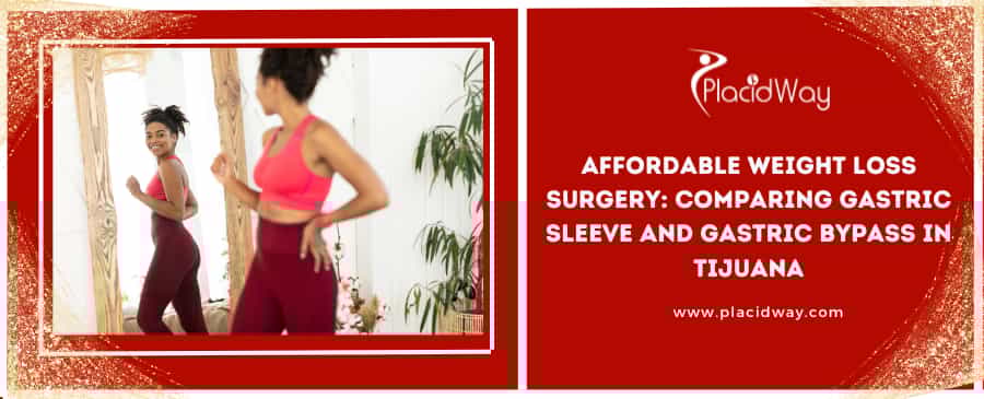 Affordable Weight Loss Surgery: Comparing Gastric Sleeve and Gastric Bypass in Tijuana