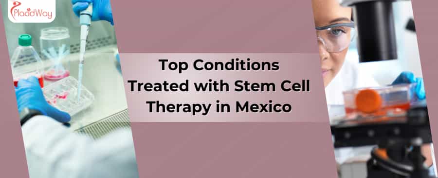Top Conditions Treated with Stem Cell Therapy in Mexico