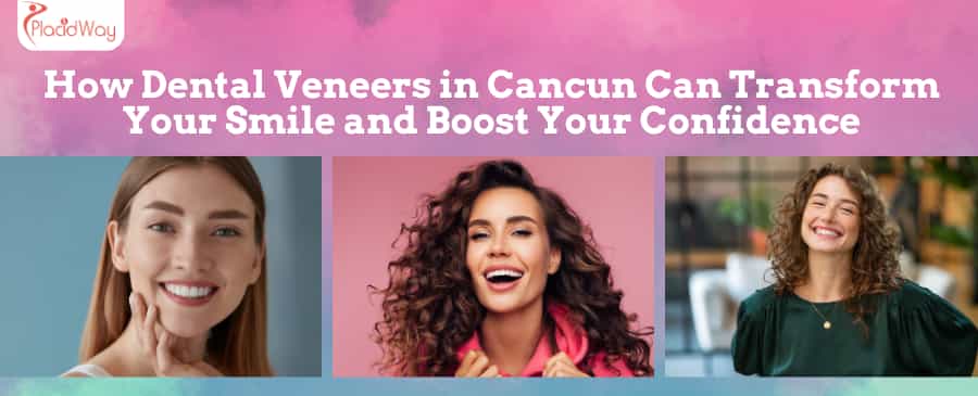 How Dental Veneers in Cancun Can Transform Your Smile and Boost Your Confidence