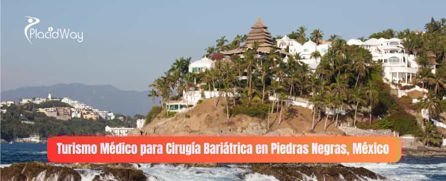 Turismo Médico para Cirugía Bariátrica en Piedras Negras, México