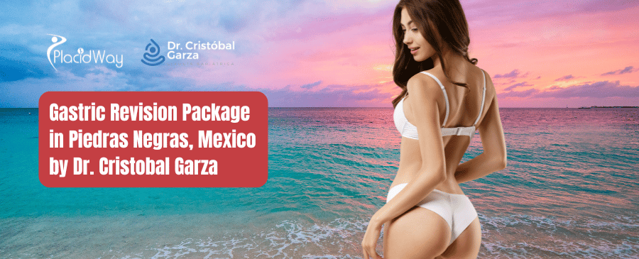 Gastric Revision Package in Piedras Negras, Mexico by Dr. Cristobal Garza