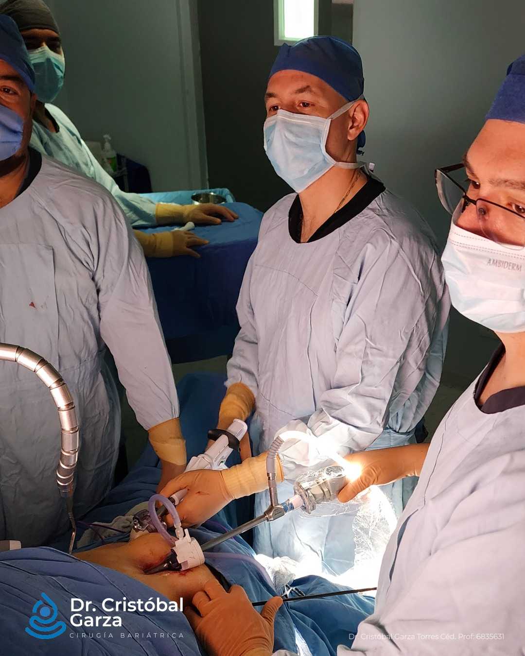 Gastric Sleeve Mexico