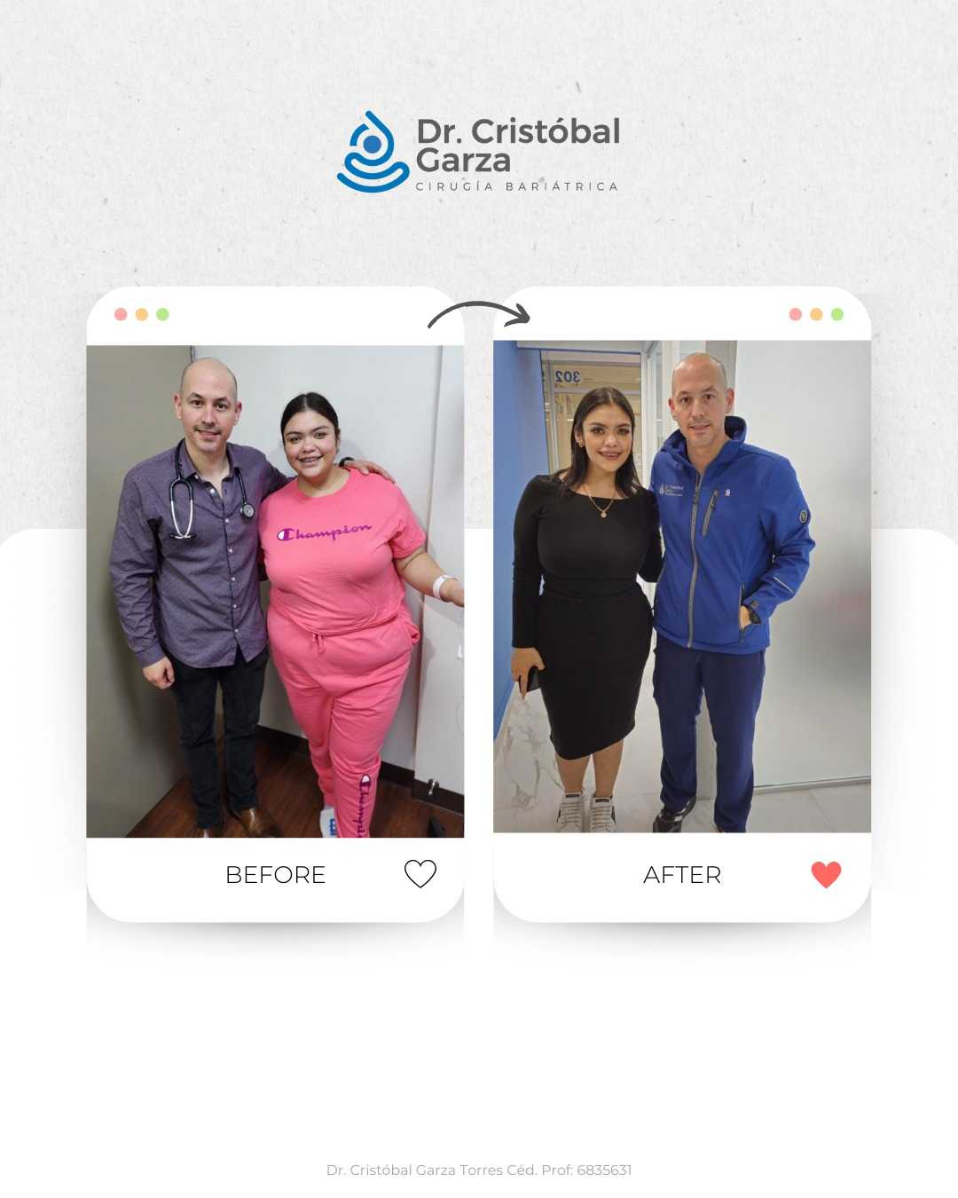 Gastric Sleeve Package in Piedras Negras Mexico