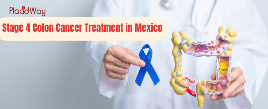 Tratamiento del cáncer de colon en etapa 4 en México