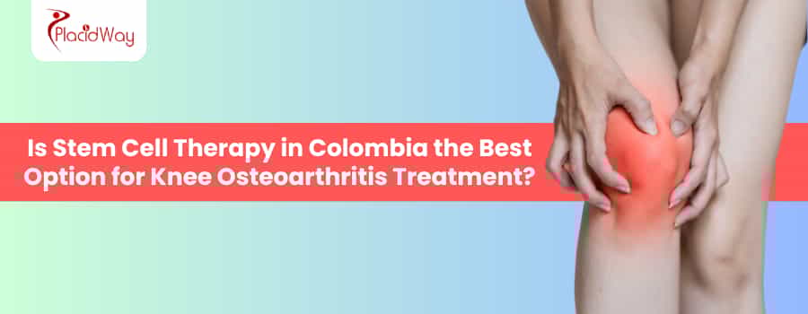 Terapia con células madre para la artrosis de rodilla en Colombia