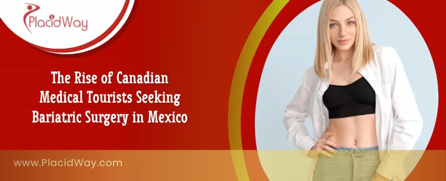 Bariatric Surgery in Mexico