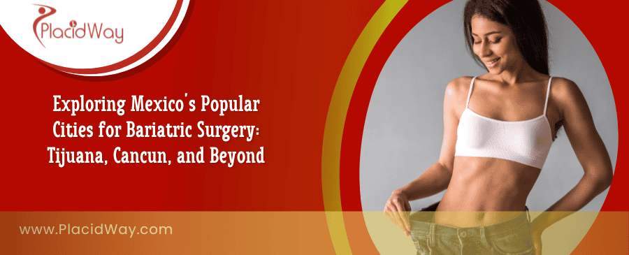 Bariatric Surgery in Mexico