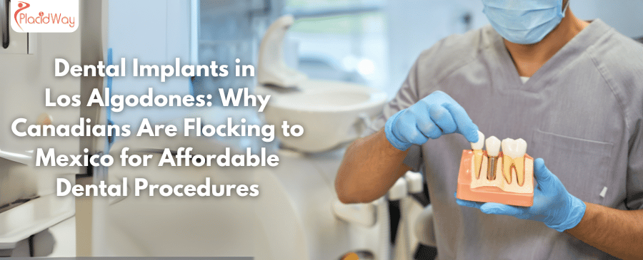 Dental Implants in Los Algodones: Why Canadians Are Flocking to Mexico for Affordable Dental Procedures