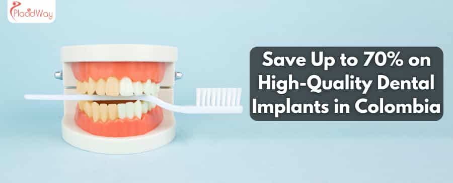 Save Up to 70% on High-Quality Dental Implants in Colombia