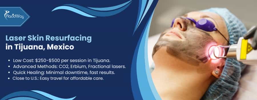 Laser Skin Resurfacing in Tijuana, Mexico
