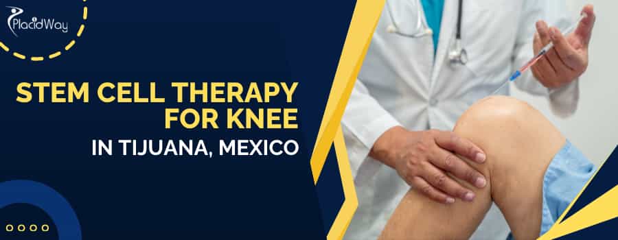 Stem Cell Therapy for Knee in Tijuana, Mexico