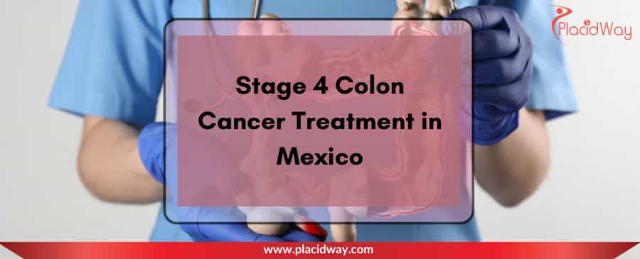 Stage 4 Colon Cancer Treatment in Mexico