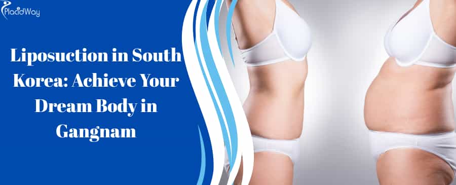 Liposuction in South Korea: Achieve Your Dream Body in Gangnam