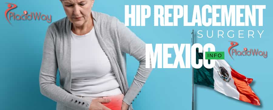 Hip Replacement Surgery in Mexicali, Mexico