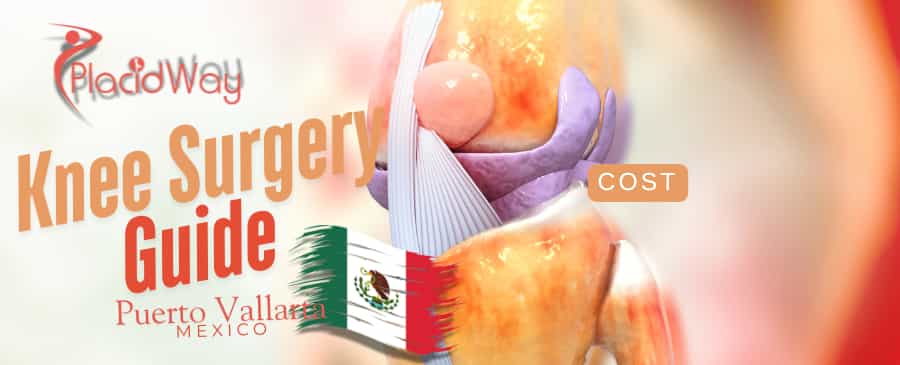  Knee Surgery in Puerto Vallarta, Mexico