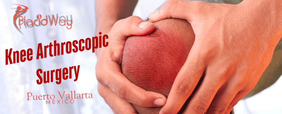Knee Arthroscopic Surgery in Puerto Vallarta, Mexico