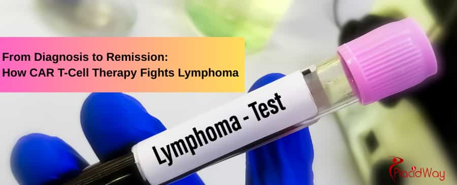 How CAR T-Cell Therapy Fights Lymphoma