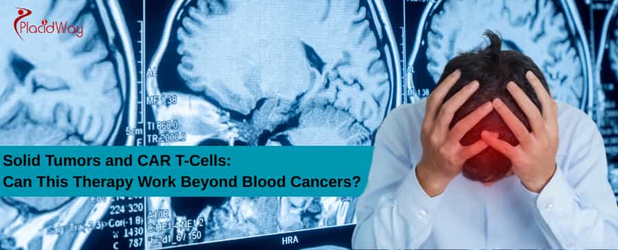 Solid Tumors and CAR T-Cells
