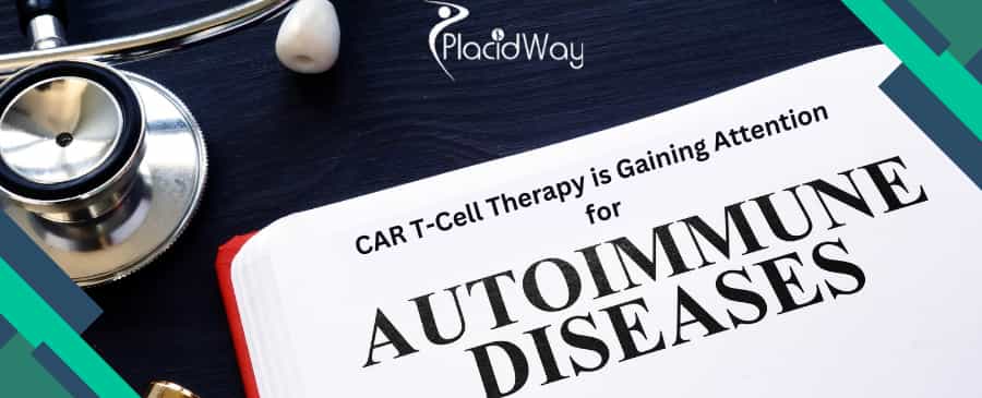 CAR T-Cell Therapy is Gaining Attention for Autoimmune Diseases