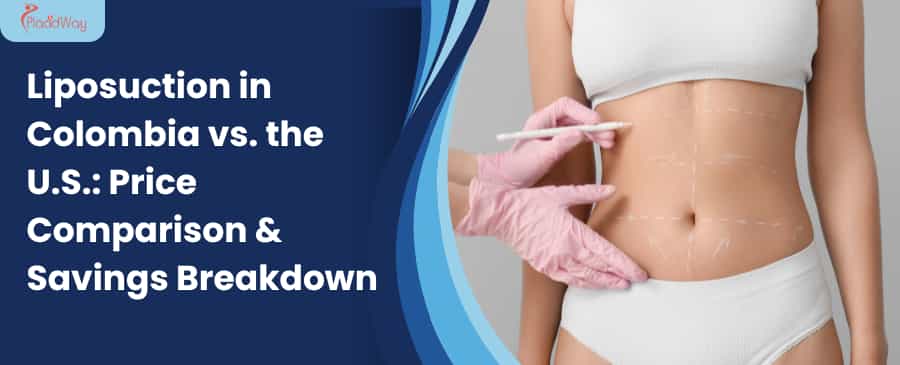 colombian surgeon drawing the lines for liposuction on patient 