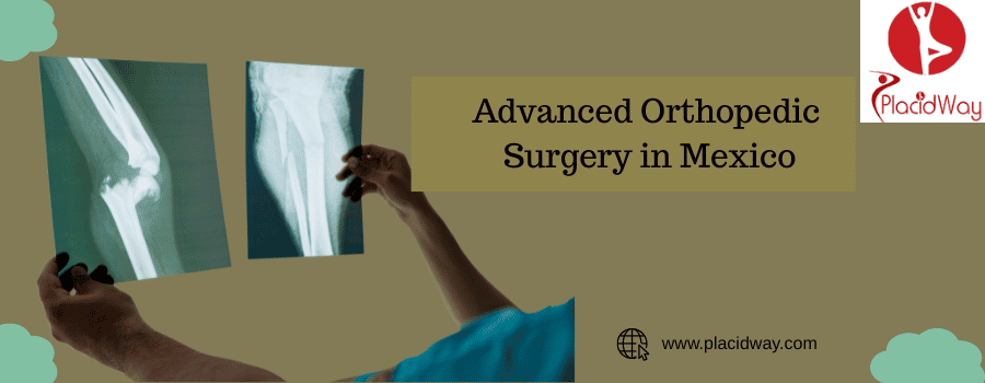 USA Are Opting for Advanced Orthopedic Surgery in Mexico