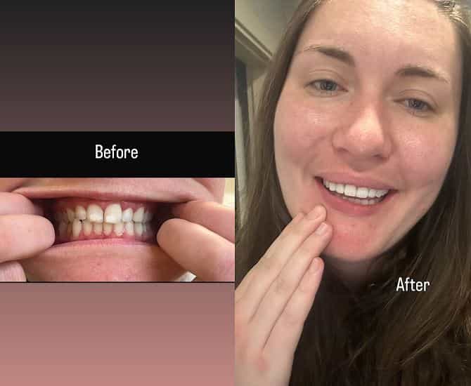 Clinic Prime Istanbul Review - Before After